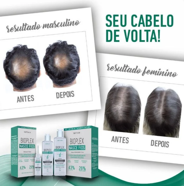 Kit Bioplex Nasce Fios - Shampoo, Condicionador e Tônico capilar - Image 2