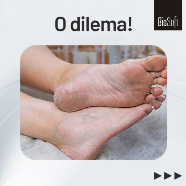 Creme Hidratante Lisa Pé Ácido Hialurônico 120g Biosoft - Image 3